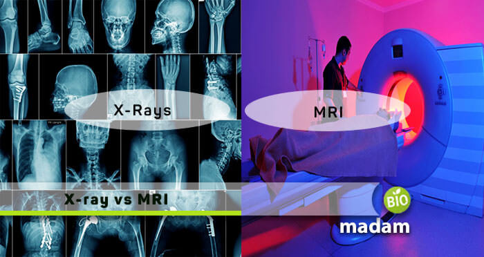 X-ray and MRI