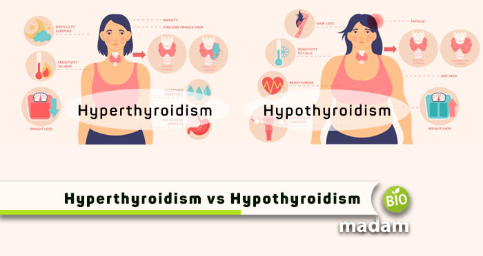 Hyperthyroidism-vs-Hypothyroidism