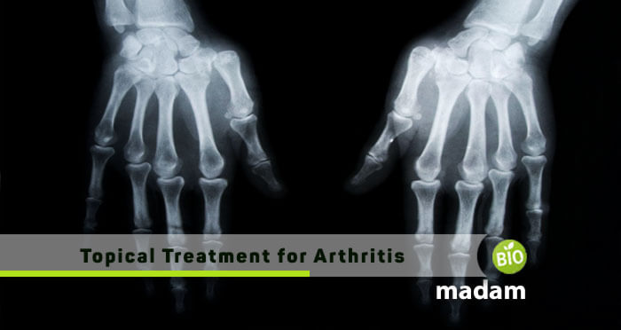 Topical-Treatment-for-Arthritis