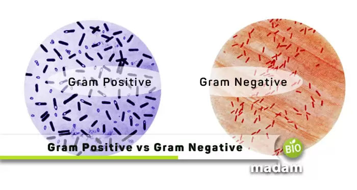 Gram-Positive-vs-Gram-Negative