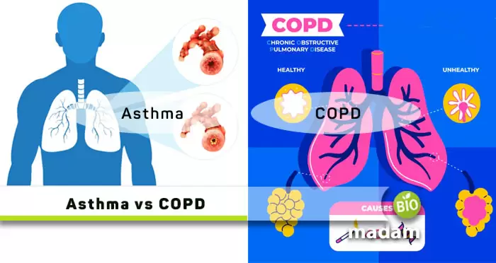 https://www.biomadam.com/wp-content/uploads/2022/05/Asthma-And-COPD.jpg.webp