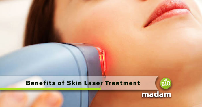 Benefits-of-Skin-Laser-Treatment