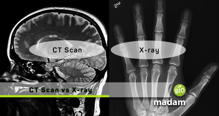 CT-Scan-and-X-ray
