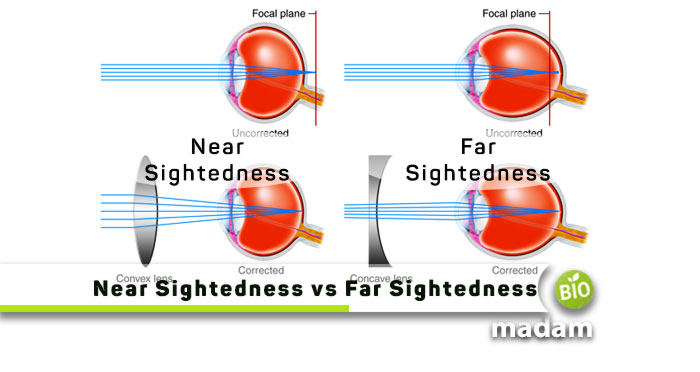 Near-Sightedness-and-Far-Sightedness