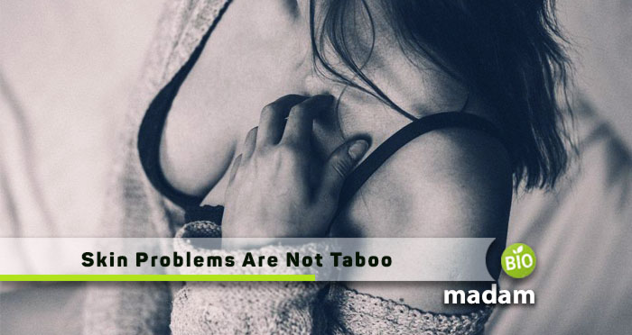 Skin-Problems-Are-Not-Taboo