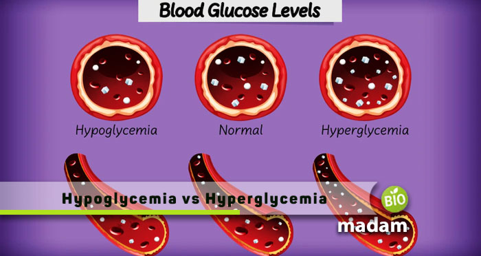 Hypoglycemia-vs-Hyperglycemia