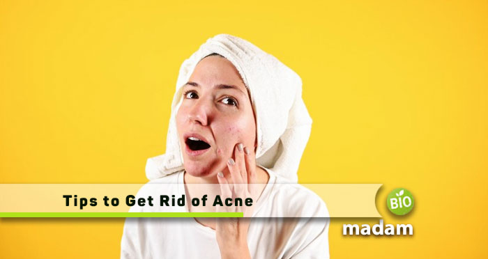 Tips-to-Get-Rid-of-Acne