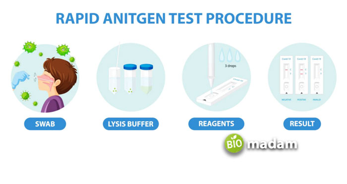 Antigen-Test