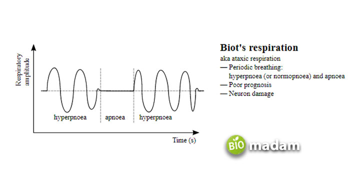 Biot’s-Breathing