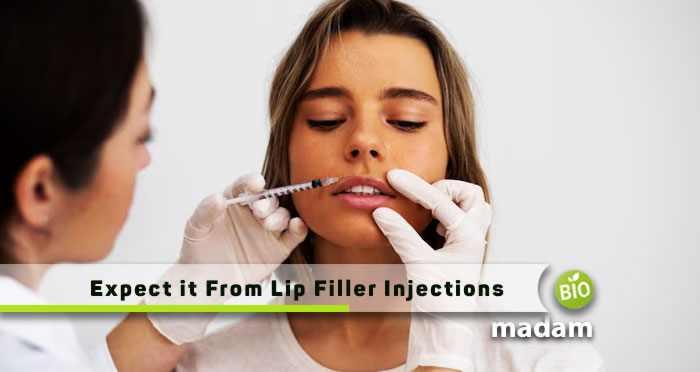 Expect-it-from-Lip-Filler-Injections