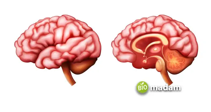 Brain-Structure