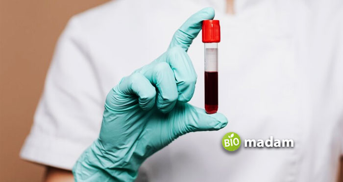 person-hand-holding-blood-test-bottle