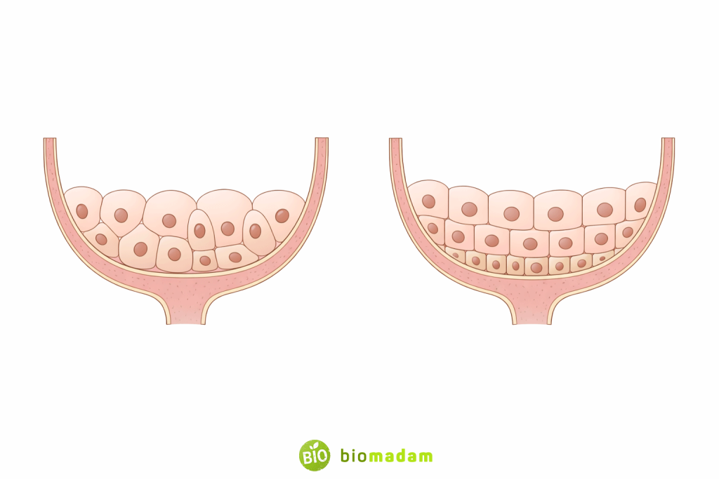 Transitional epithelium showing relaxed and stretched states in the urinary bladder